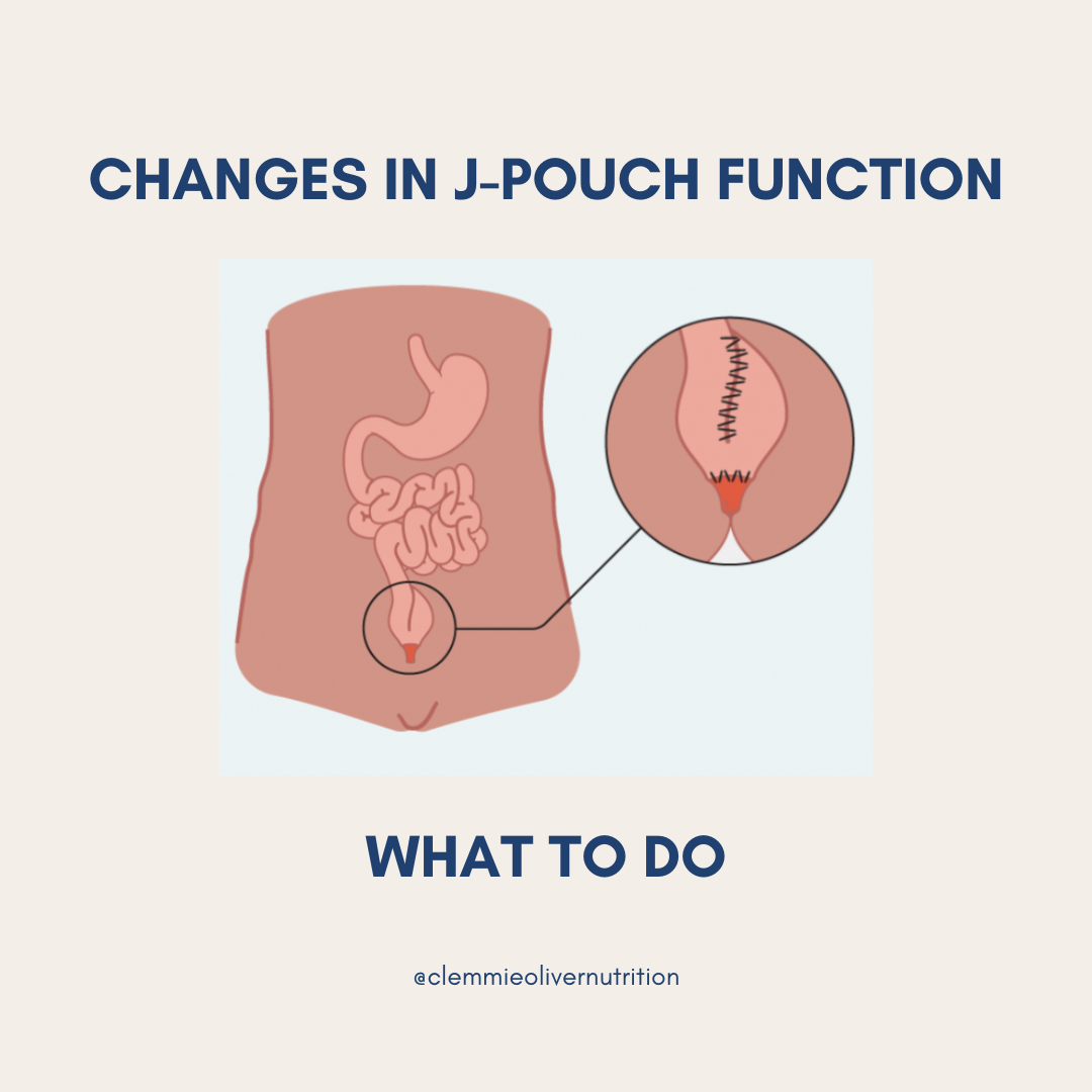 Pouchitis - symptoms and what to do