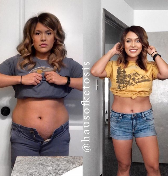 Intermittent  Fasting, Ketogenic Diet, and Hypothyroidism Symptoms