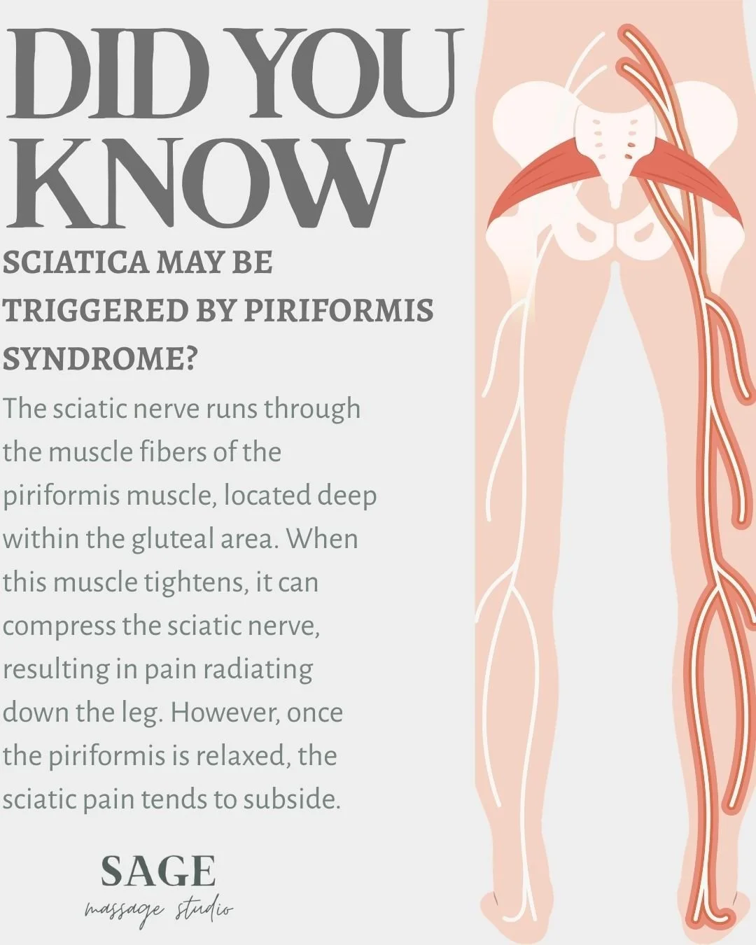 The sciatic nerve runs through the muscle fibers of the piriformis muscle, located deep within the gluteal area. When this muscle tightens, it can compress the sciatic nerve, resulting in pain radiating down the leg. However, once the piriformis is r