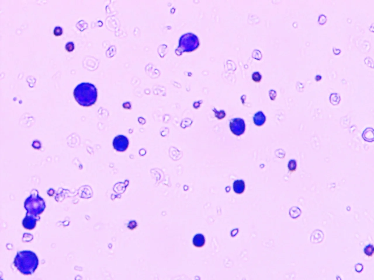 Mononuclear cells isolated in a Stem Cell Procedure at Boulder Biologics