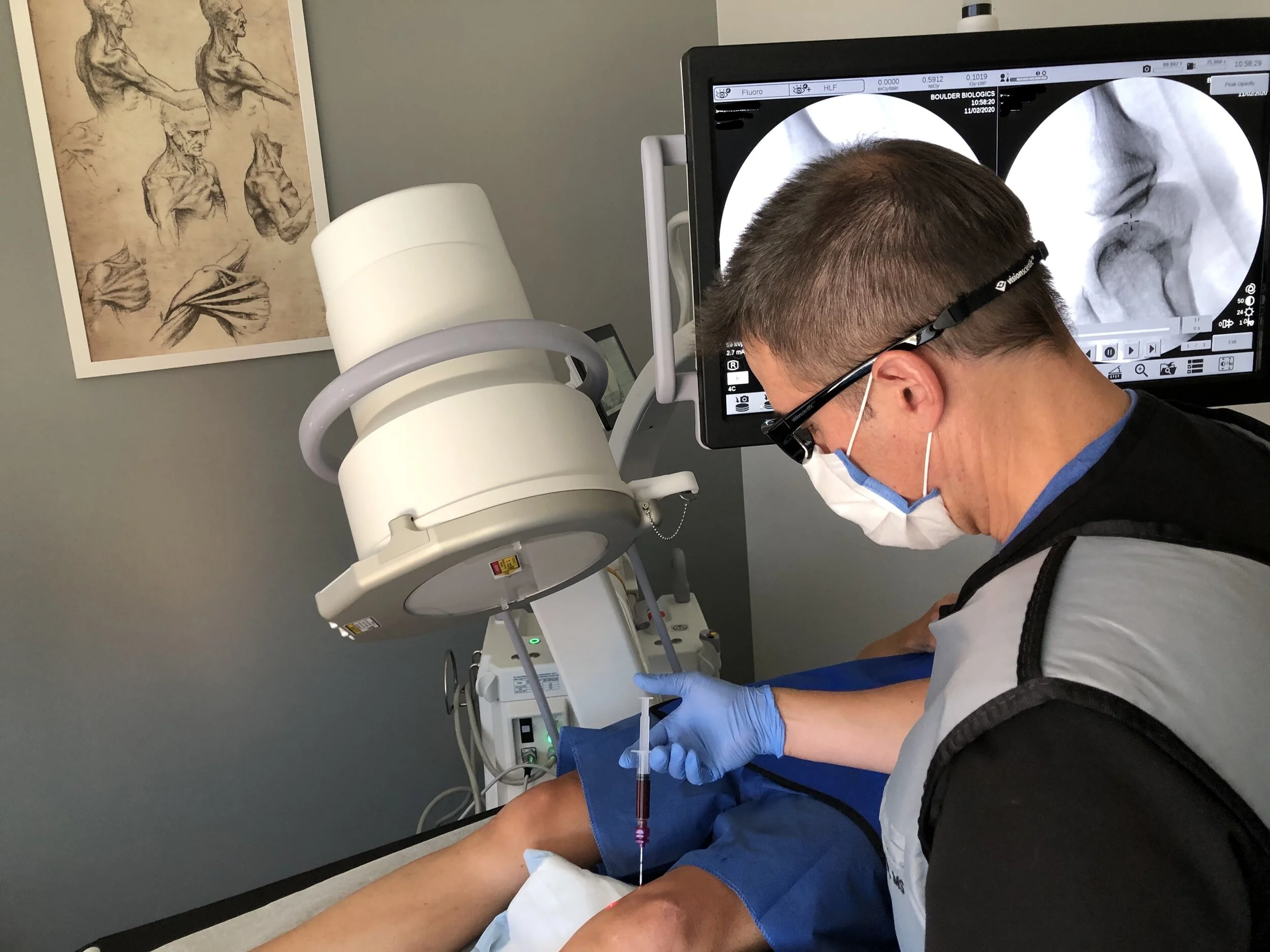 Boulder Biologics Integrative and Regenerative Medicine Stem Cells