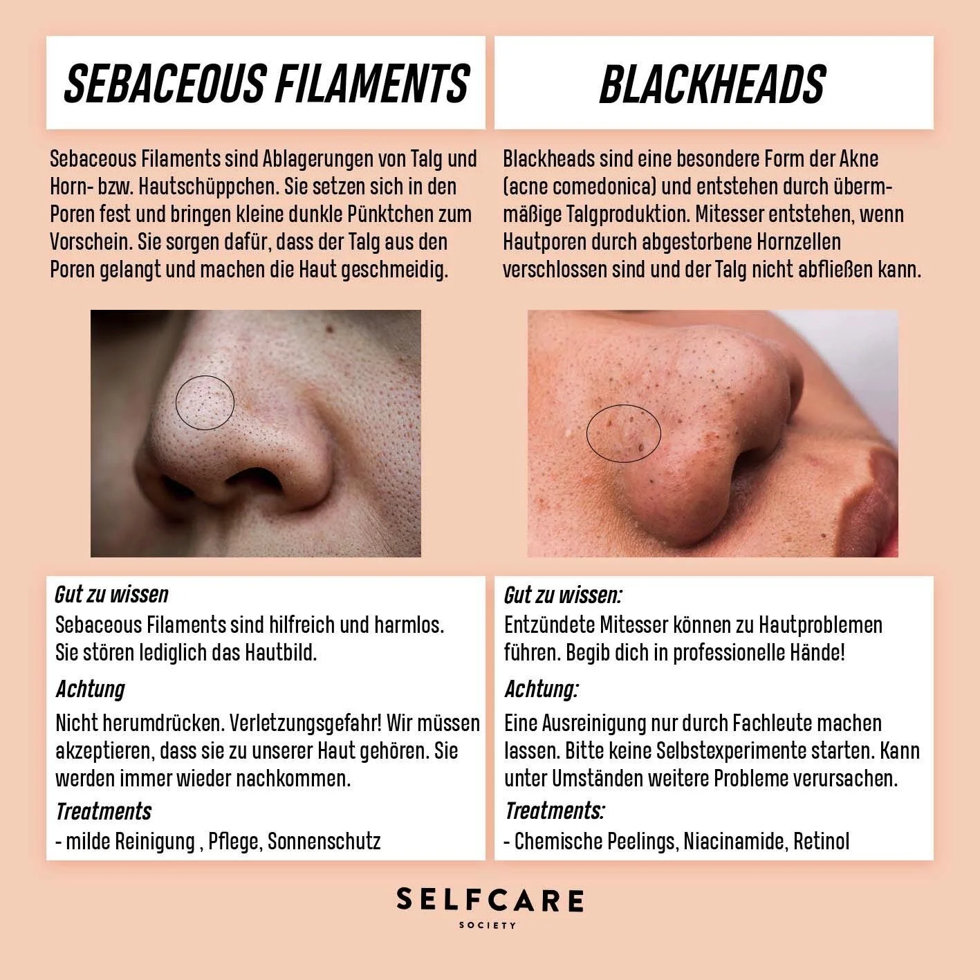 Learning Together : Mitesser oder Sebaceous Filaments? Was ist der Unterschied? 
