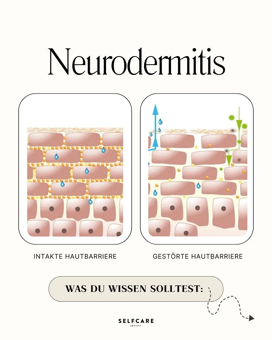 Anl&auml;sslich des World Atopic Eczema Day (Welt-Neurodermitis-Tag) heute, am 14. September, m&ouml;chte ich in Zusammenarbeit mit AbbVie @abbvie_austria sowie Dr. Doris Weiss @dr.doris.weiss und Dr. Johannes Bisschoff @medizinamhbf diesen Neuroderm