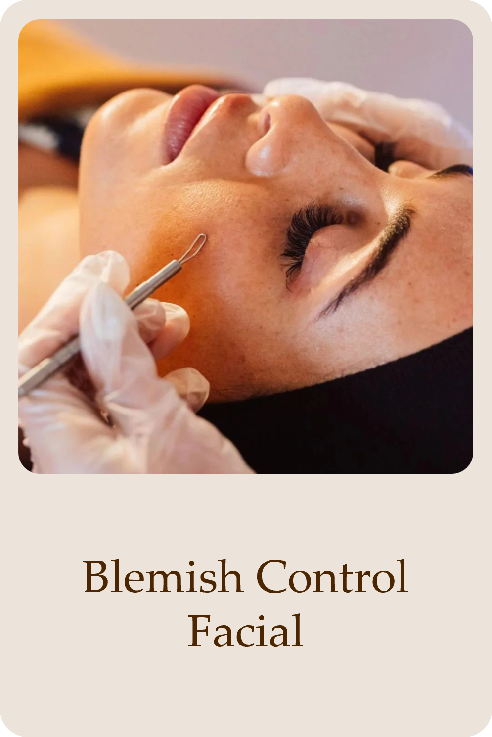 blemish control facial tile.png