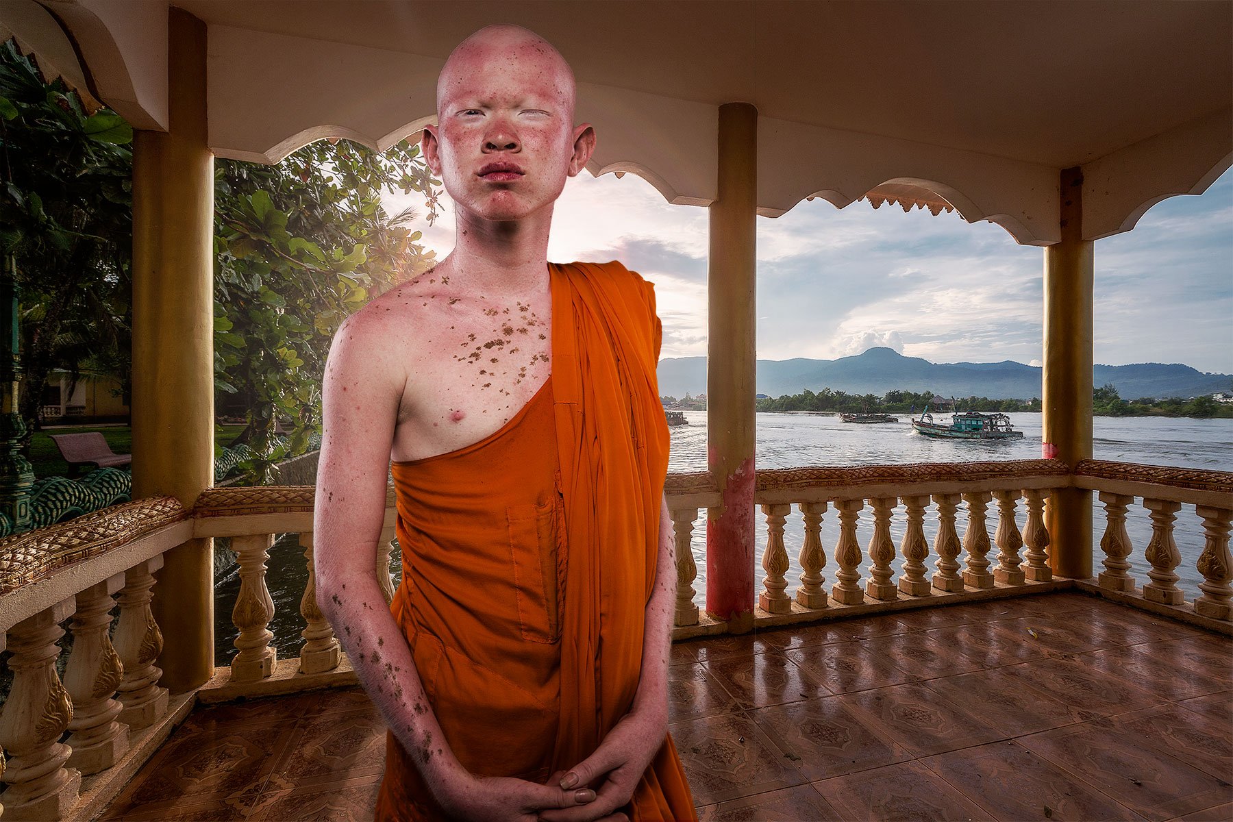 Albino Monk | Cambodia - Faces and Places