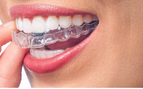 Invisalign_top_provider_sydney_dentist_orthodontist.jpg