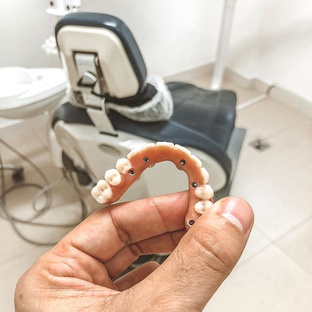 Mais um Protocolo Carga Imediata @straumannbr . Aqui, na maioria dos casos finalizamos os protocolos no mesmo dia. Cirurgia e Protese em um dia inteiro de muito trabalho de todos os envolvidos!
#dentista #odontologia #odontologiadigital #3shape #ciru