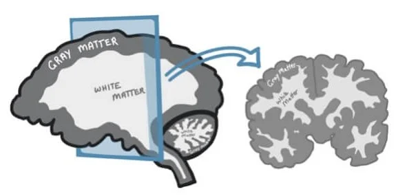 gray and white matter inside the brain