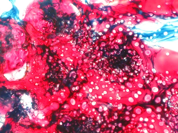 Americanus Succulus (close up)
