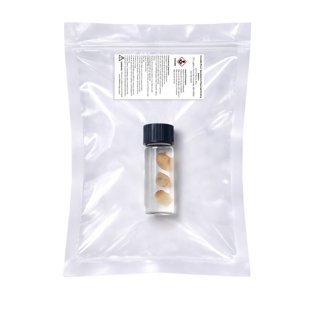 Preserved Northern Lampshell (Terebratulina septentrionalis) – Marine Brachiopod Specimen