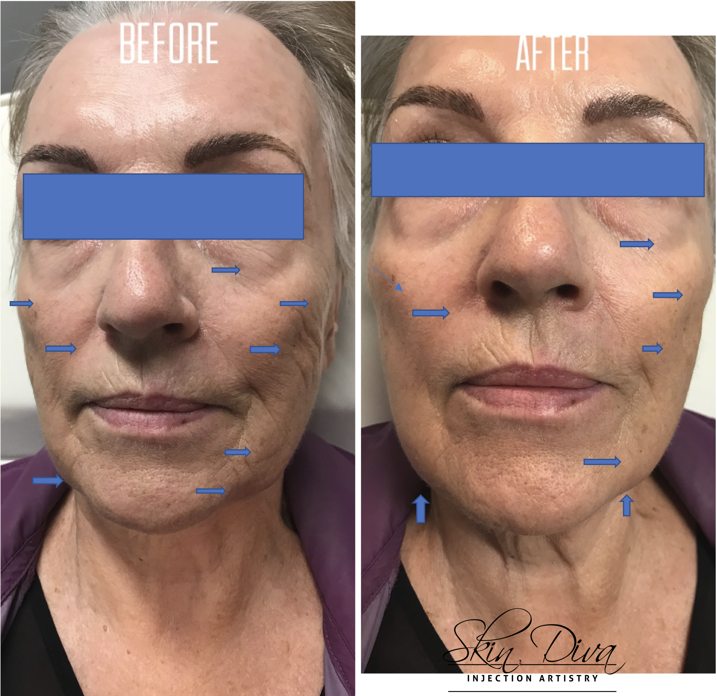 Screen Shot 2018-08-11 at 8.36.41 AM.png