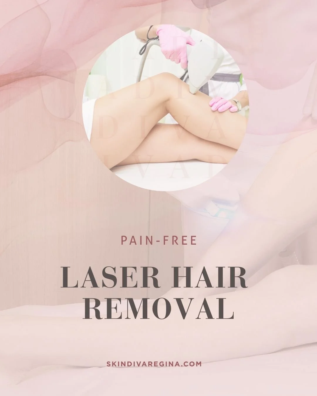 A person receiving laser hair removal treatment on their legs in a clinic setting with a healthcare professional wearing pink gloves. The image promotes pain-free laser hair removal services offered by skindiva Regina.