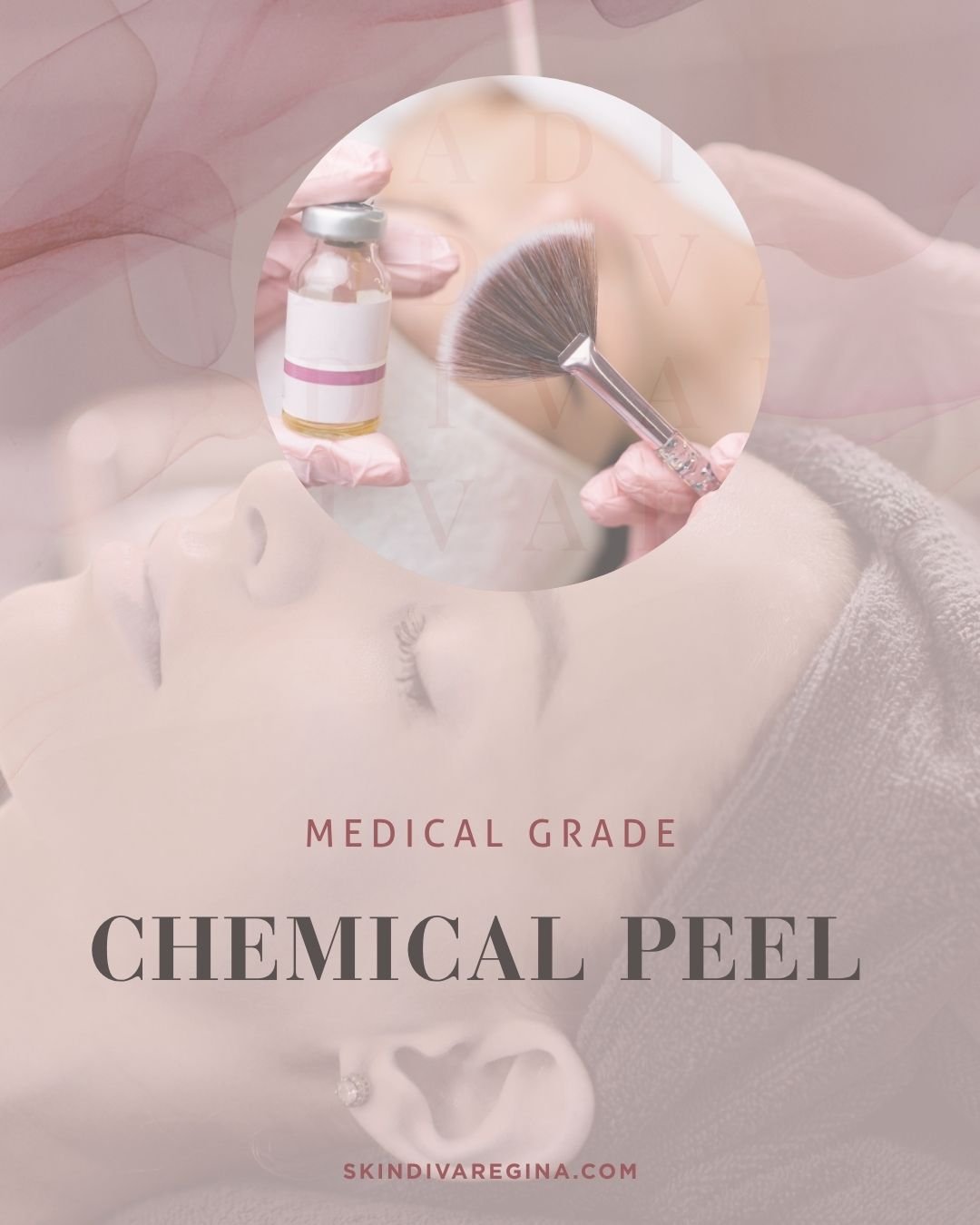 A medical professional wearing gloves holds a small vial of chemical peel solution and a brush. The background features a woman lying down with her eyes closed, indicating a skincare or cosmetic treatment.