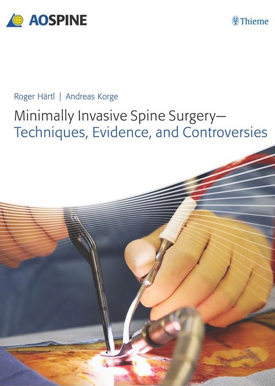 minimally invasive spine surgery techniques evidence and controversies.jpg