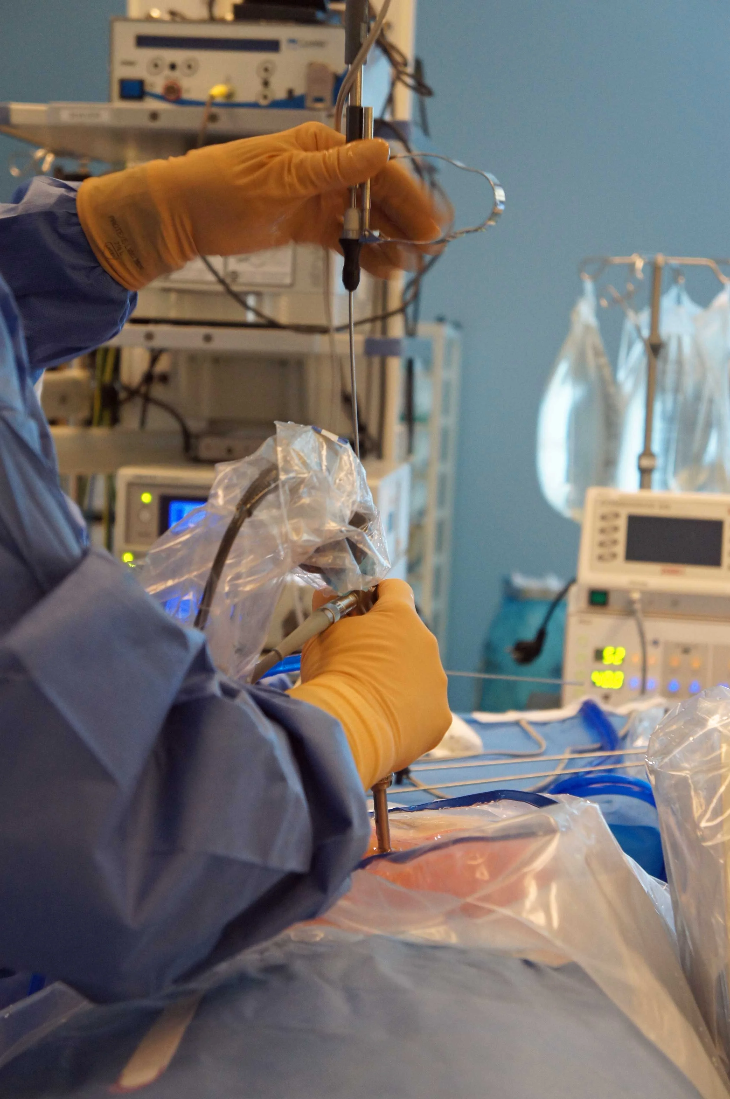 full-endoscopische discectomie interlaminaire toegang operatiezaal setup