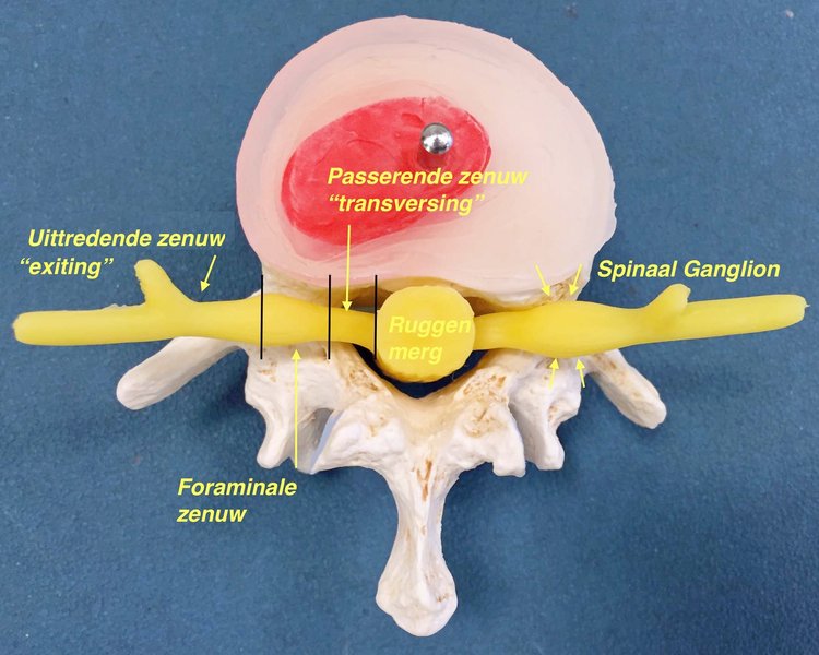 Anatomie van de onderrug — Rug Endoscopie- Dr. P. Van Daele