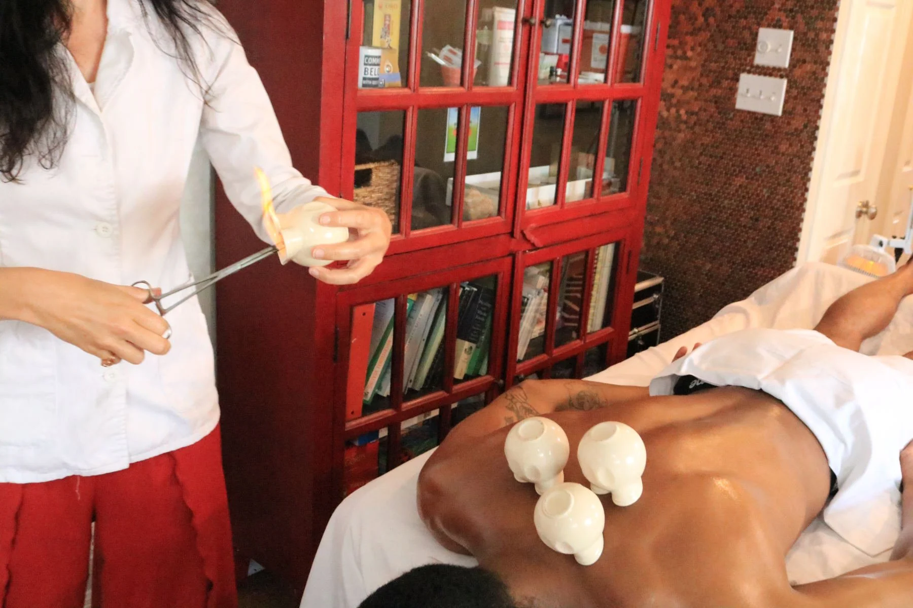 Dr-Jenna-Valentine-Cupping-Patient-6468-1800w.JPG