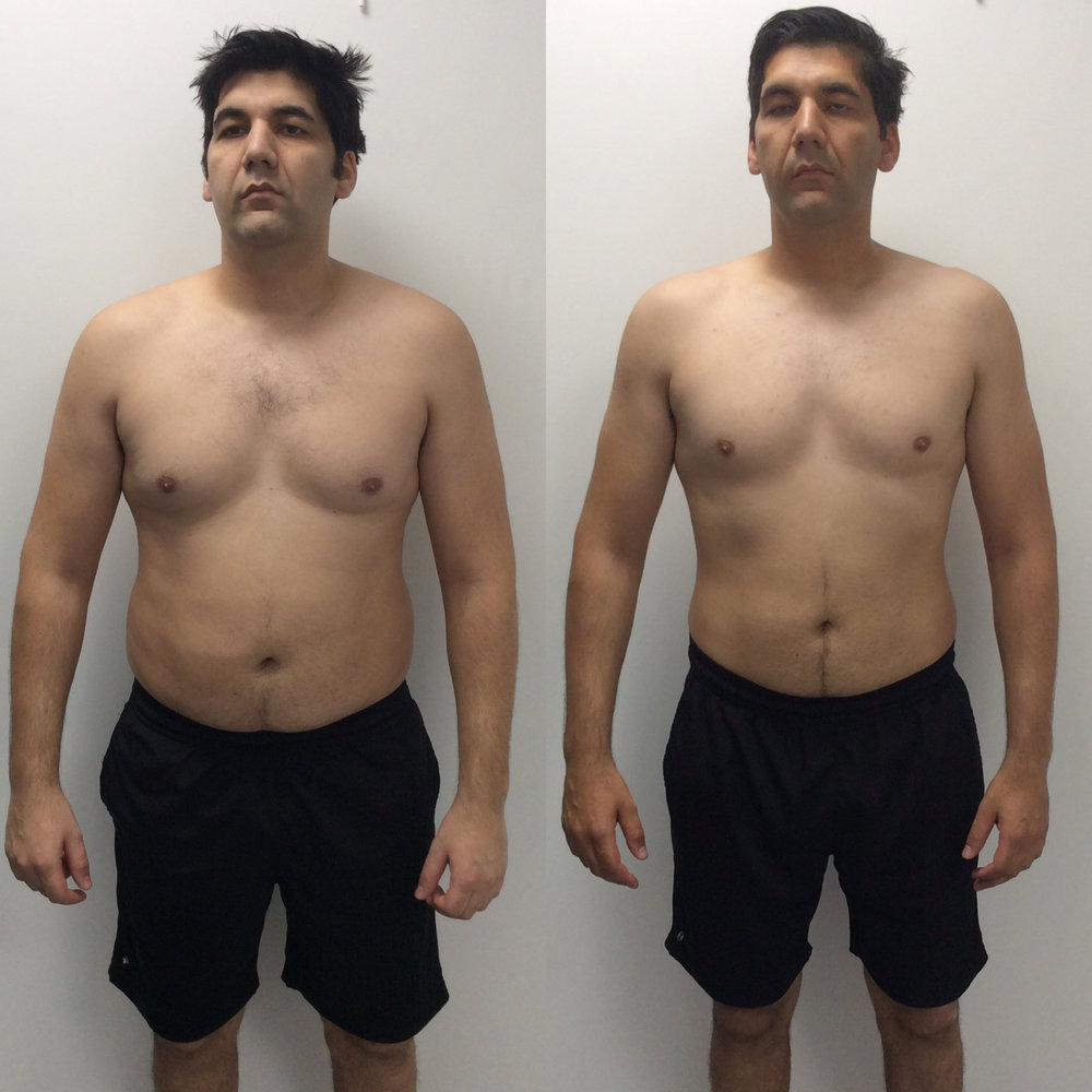 Asan+before+and+After.jpg