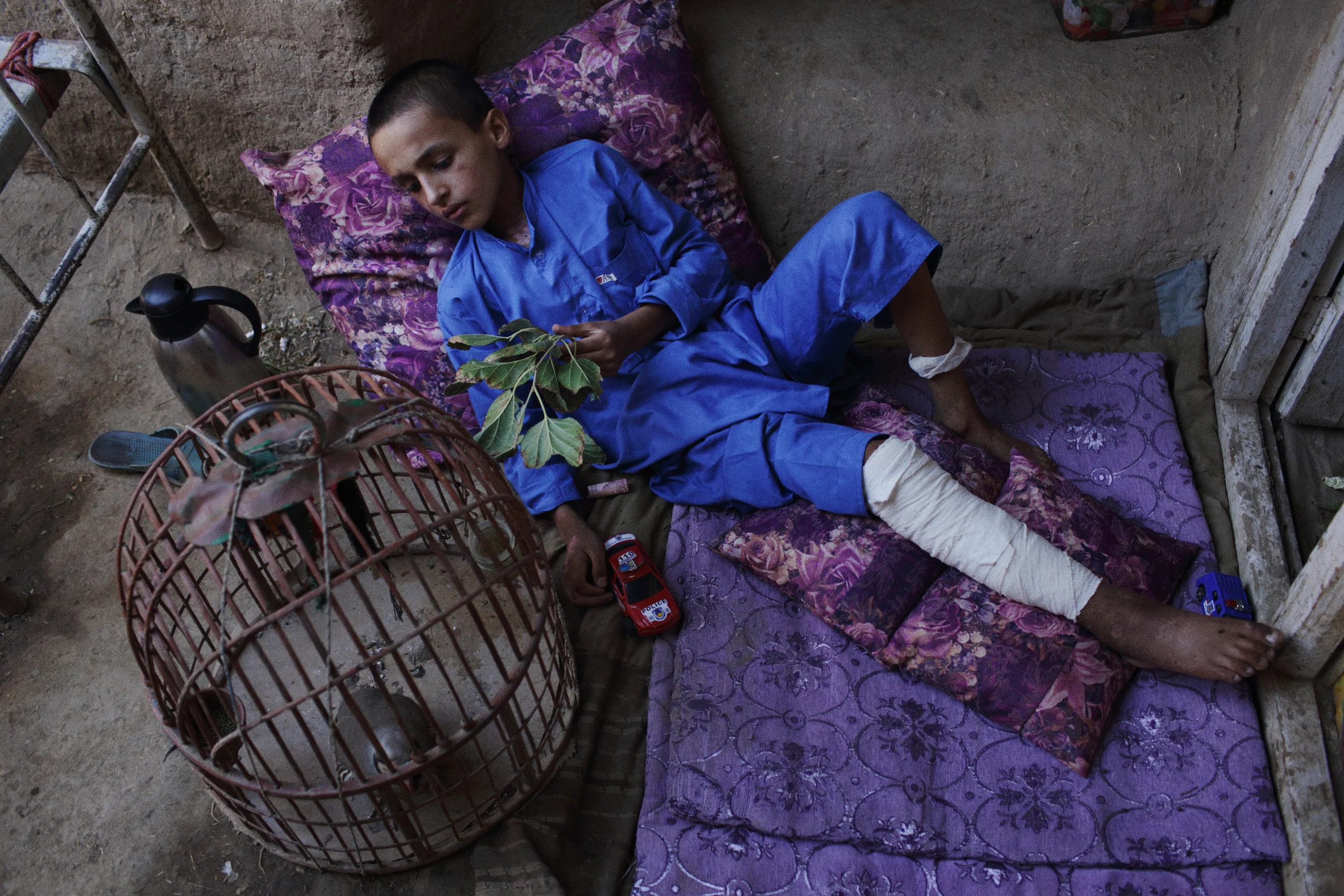  Jamshid plays with his pet partridge while nursing injuries suffered when a suicide bomber targeted a NATO convoy that had stopped near where he and his friends were playing football. His older brother was killed in the bombing. Parwan Province, Aug
