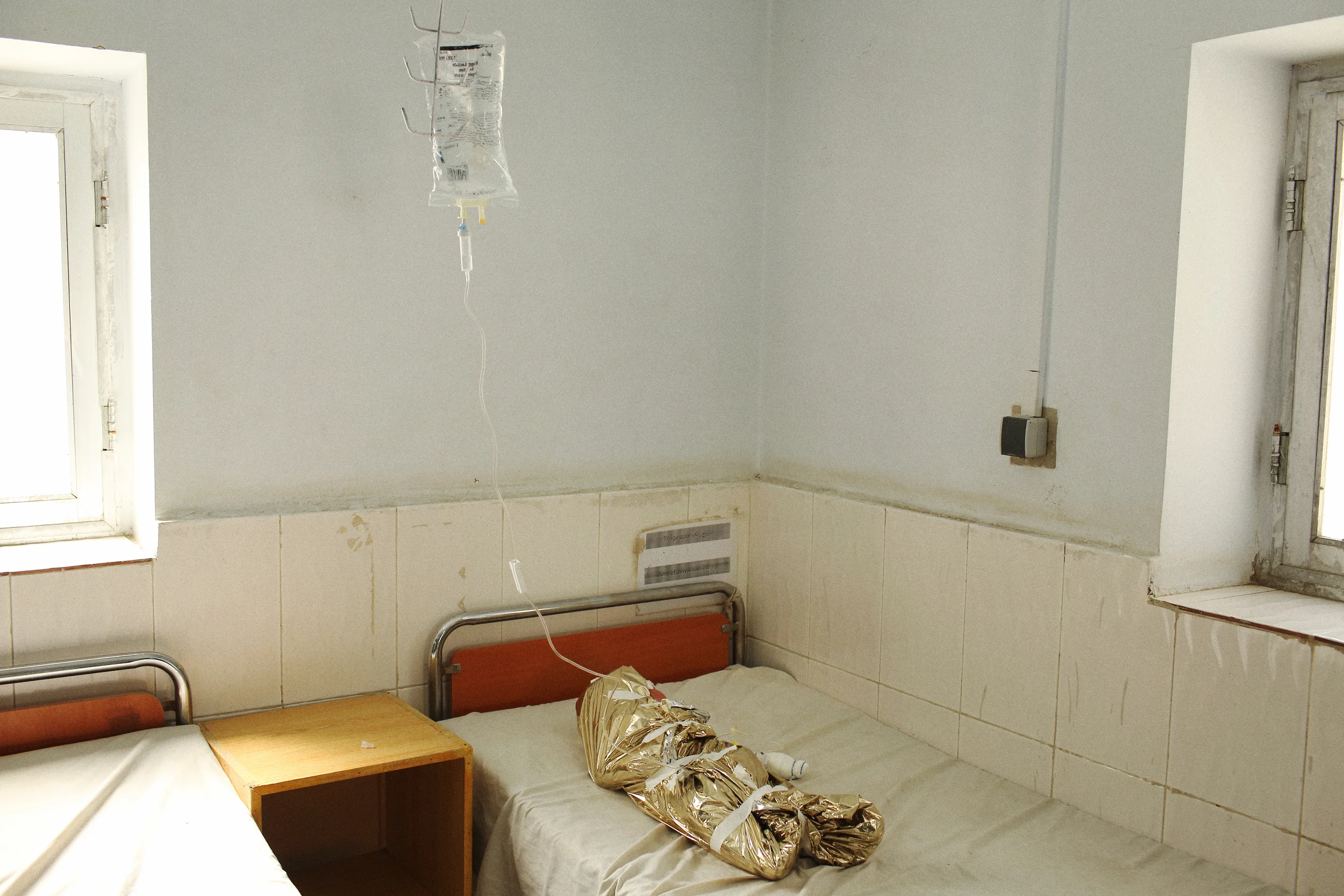  An infant girl recovers in Helmand’s Bost Hospital after suffering severe burns in an accident with a home oil heater. Helmand Province, February, 2014. 