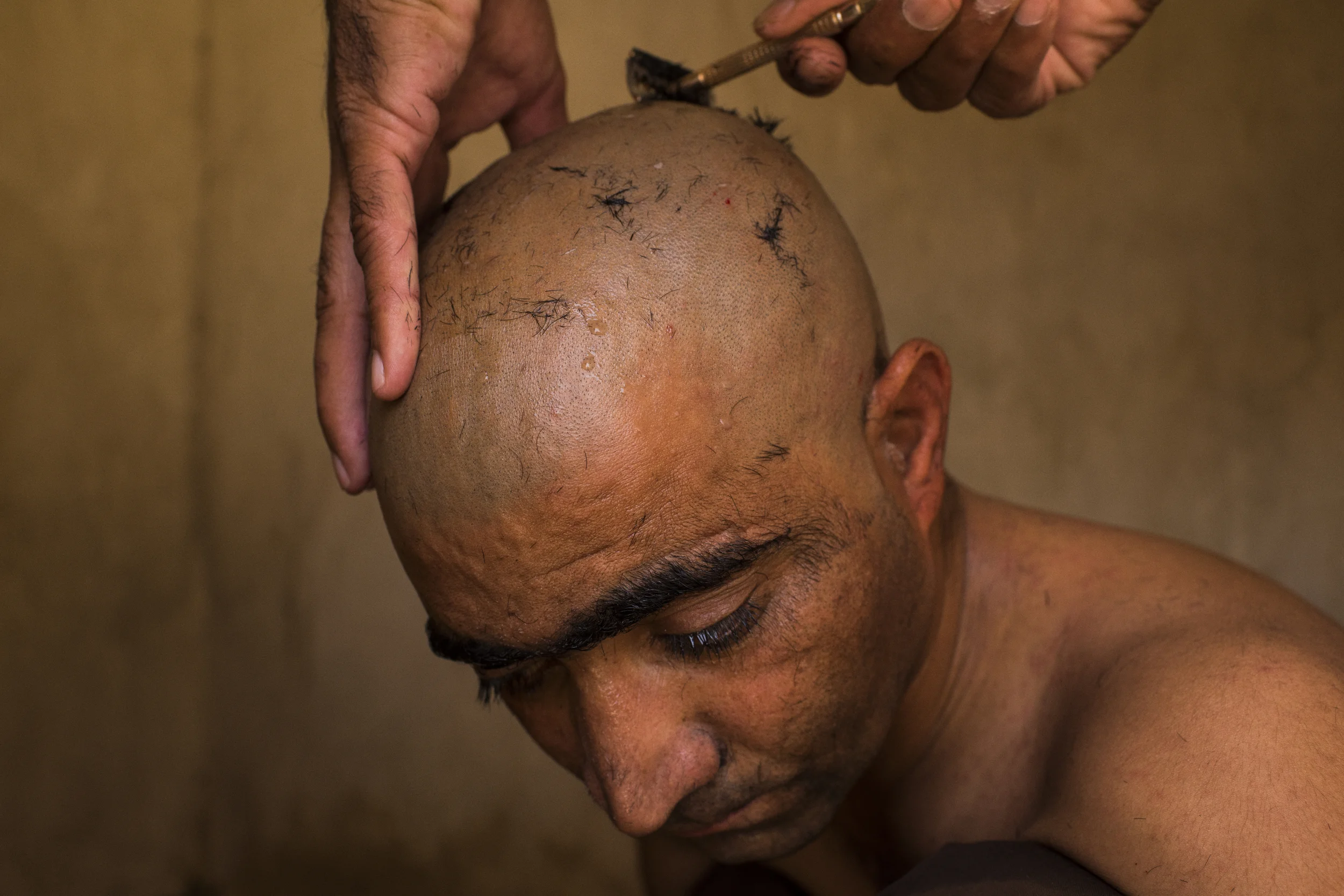  27-year-old Abdul Manan, who arrived at the Chigini drug rehabilitation clinic outside Zaranj, in far southwestern Afghanistan, five days prior, has his head re-shaved for hygiene purposes. Treatment at Chigini, which was hated by its patients, didn