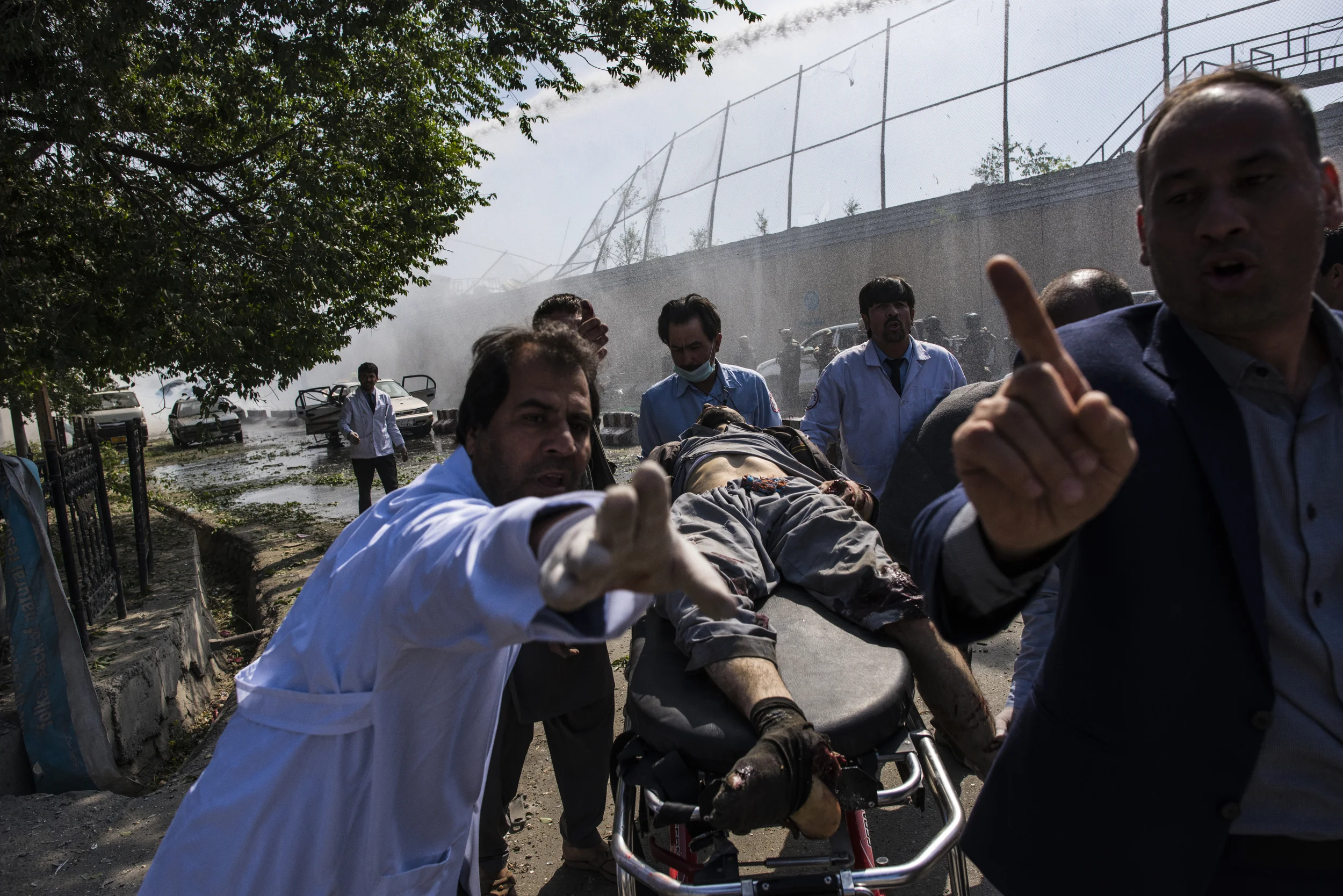  An victim is stretchered to an ambulance near the site of a truck bomb that killed 150 and wounded nearly 500. Kabul, May, 2017. 