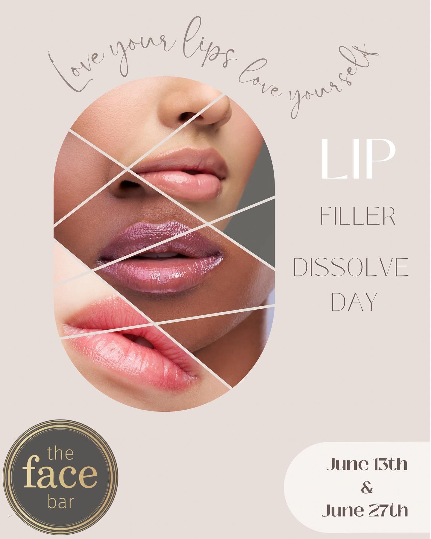JUNE SPECIAL☀️ 
 
Let&rsquo;s give your lips a makeover out of this world💋

On June 13th and 27th for only $850 you can come get all your lip filler dissolved and pre pay for your next syringe!  #freshstart