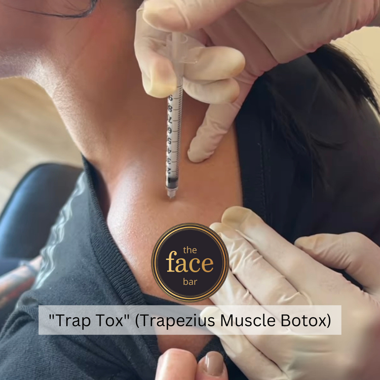 trap tox barbie botox neck botox botox lean neck — The Facebar Migraine Clinic and Medspa