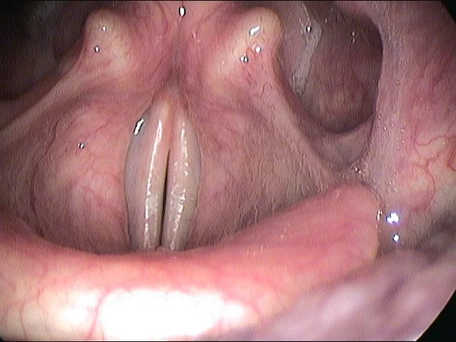 Fiberoptic Pic.jpg