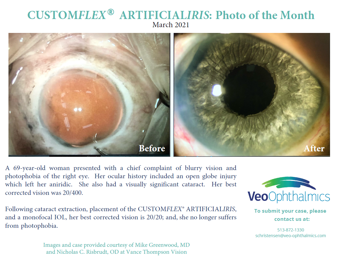 CUSTOMFLEX ARTIFICIALIRIS Photo of the Month - March 2021.PNG
