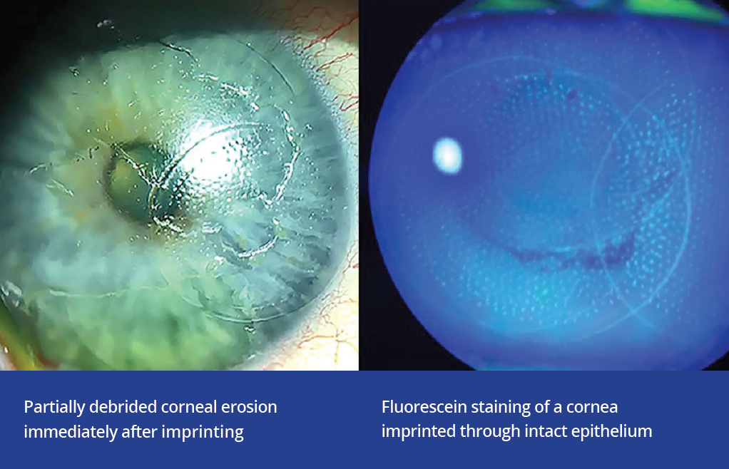 Fig 4 with caption.PNG