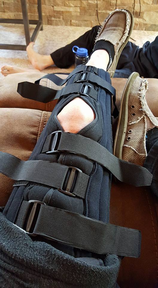 ACLTear.jpg