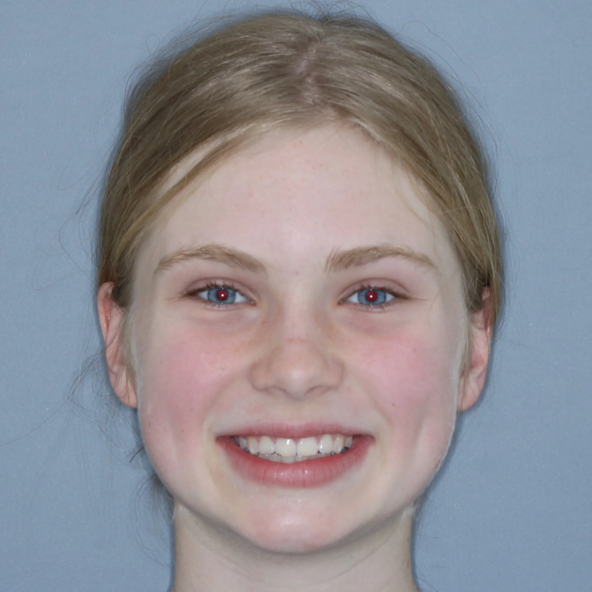 Albany Orthodontics Gallery