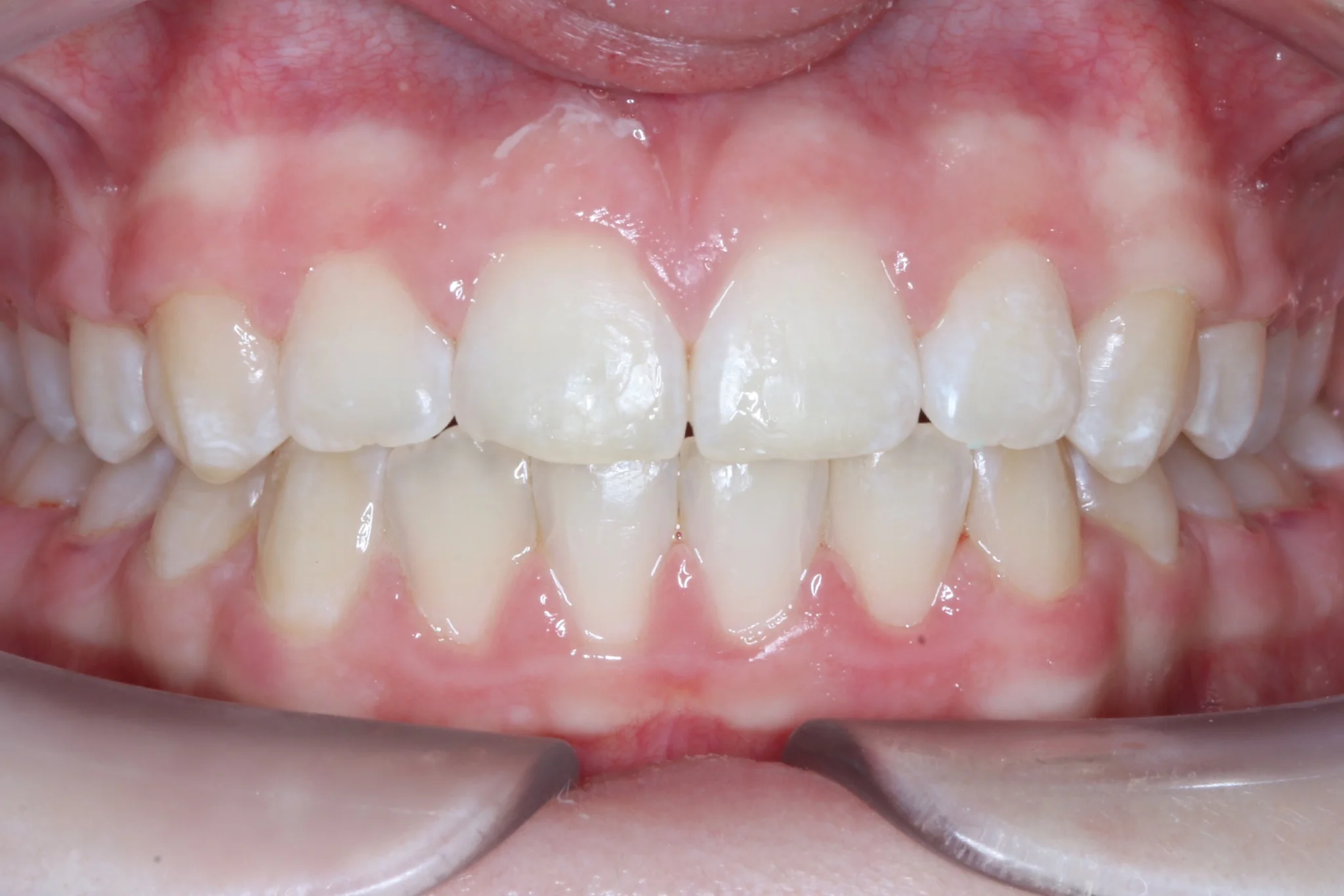 Albany Orthodontics Gallery