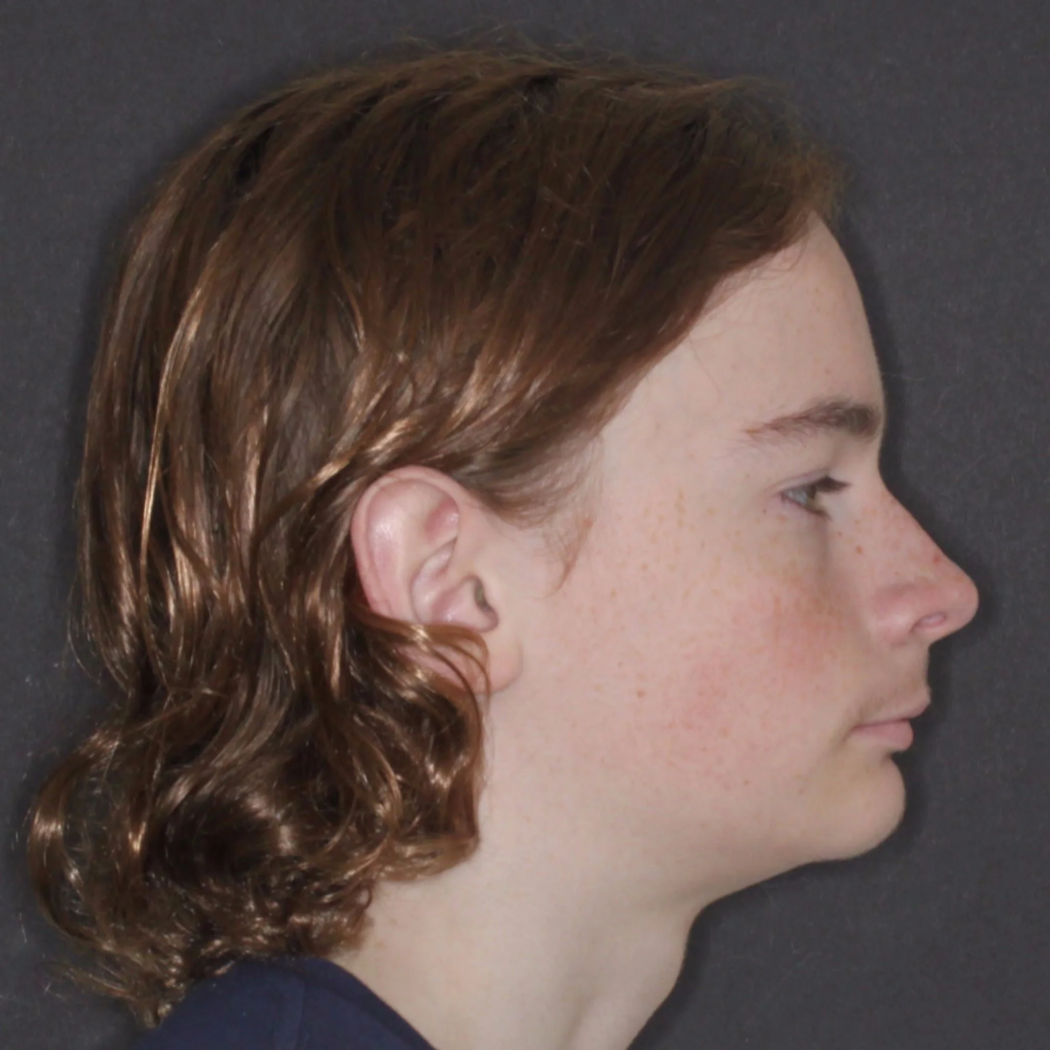Albany Orthodontics Gallery