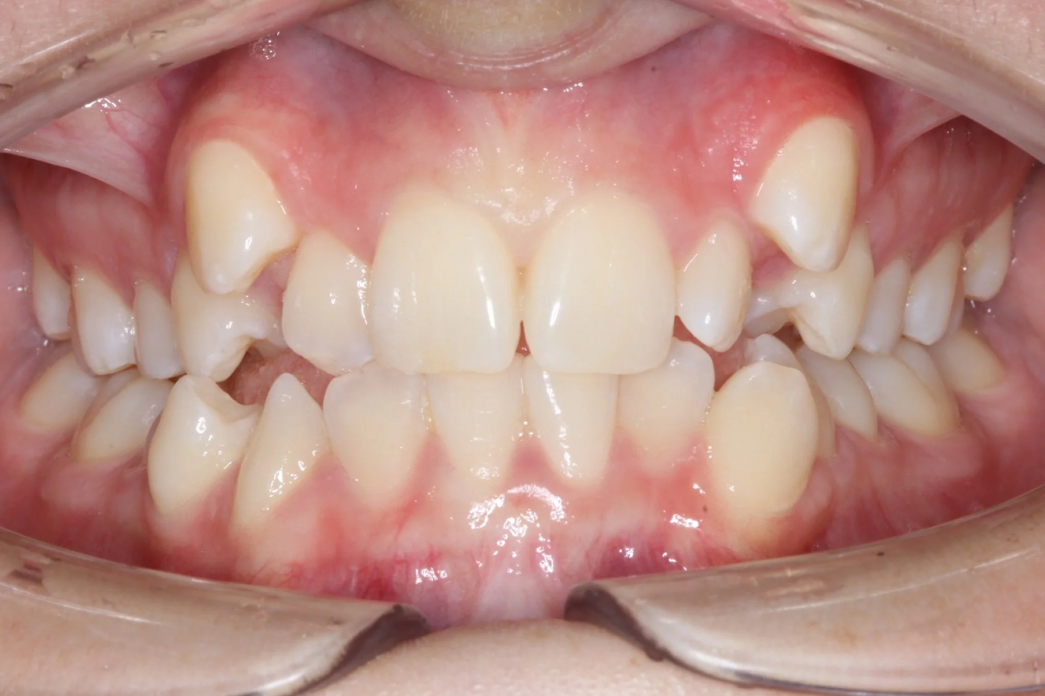 Albany Orthodontics Gallery