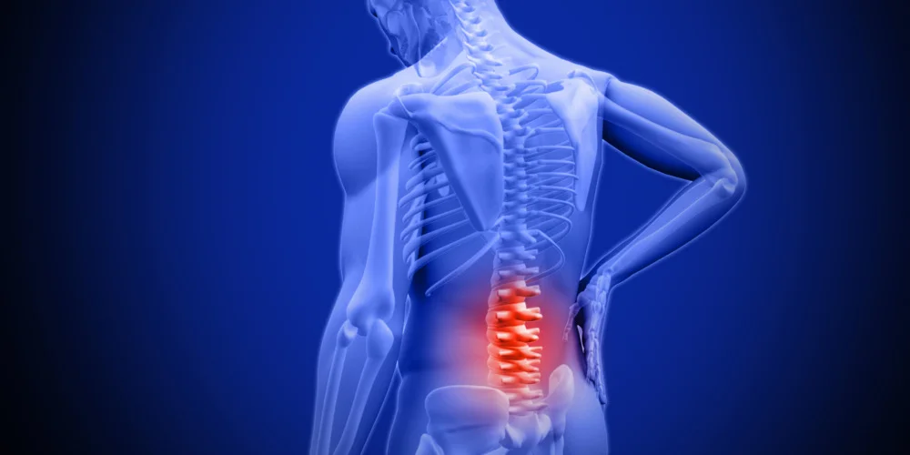 The Low Down on Lower Back Pain