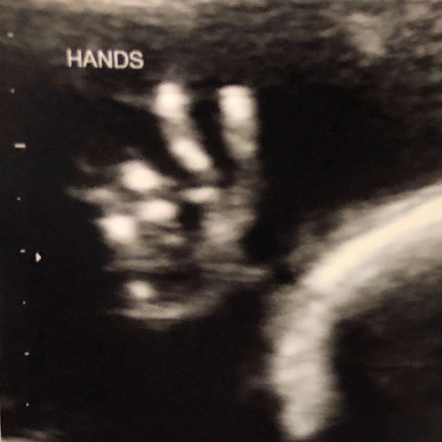 MAGIC to Master[peace]…