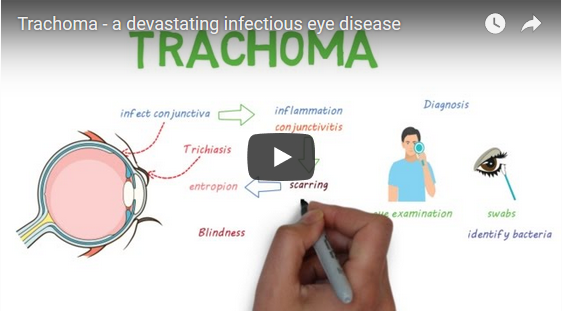Learn About Trachoma - Video