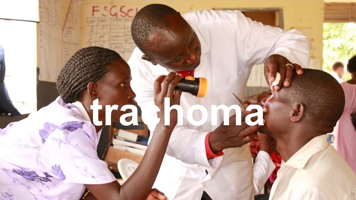 Trachoma Image with Text.jpg