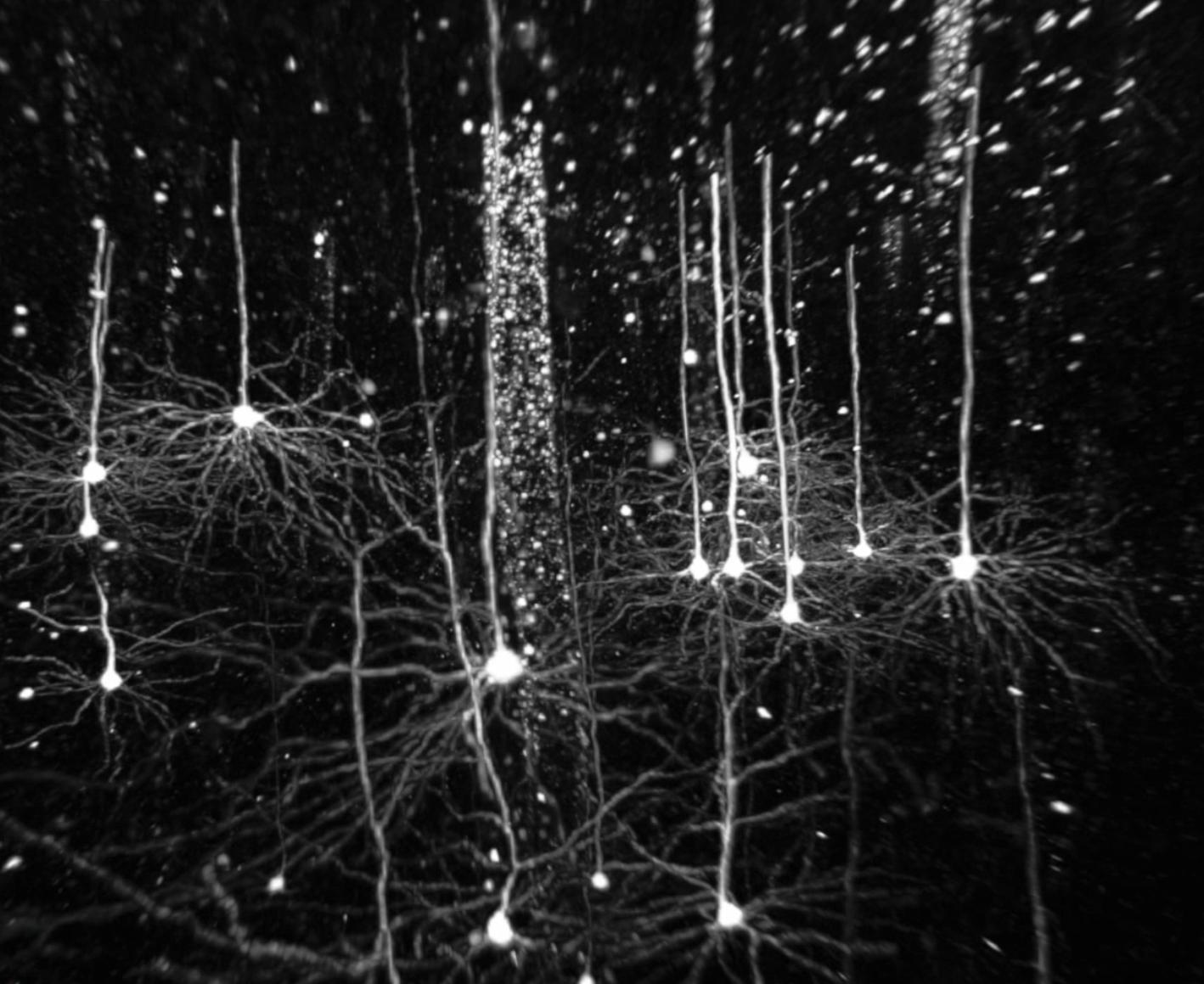 neuron_forest.PNG