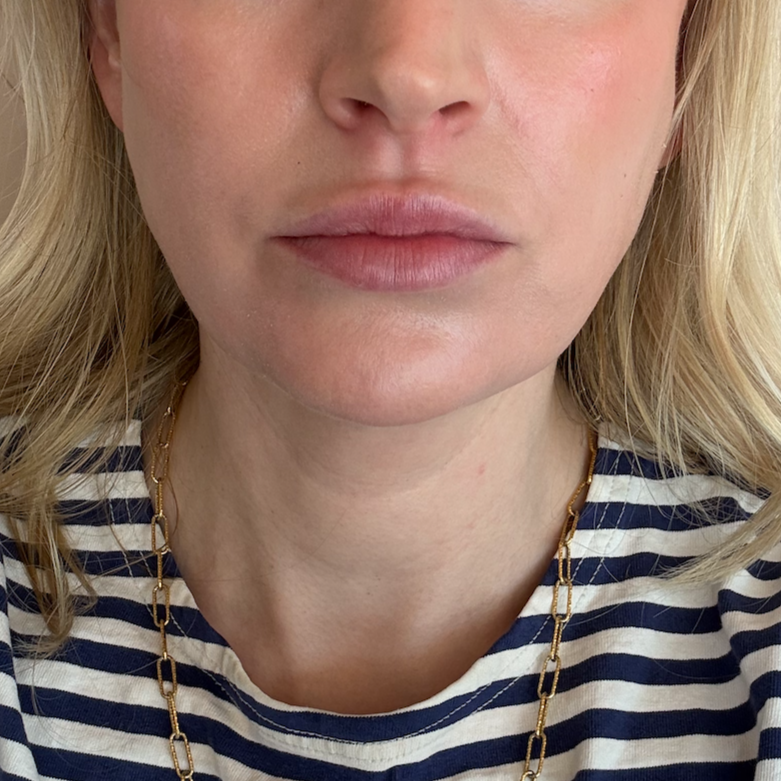 2 Sessions of Polynucleotides