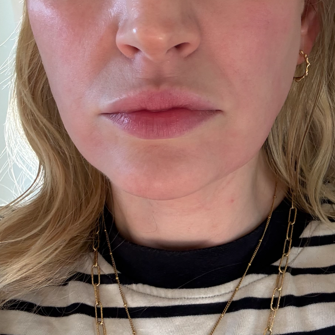 Before Polynucleotides