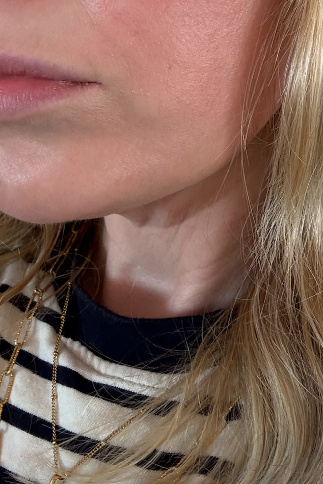 Before polynucleotides for the neck