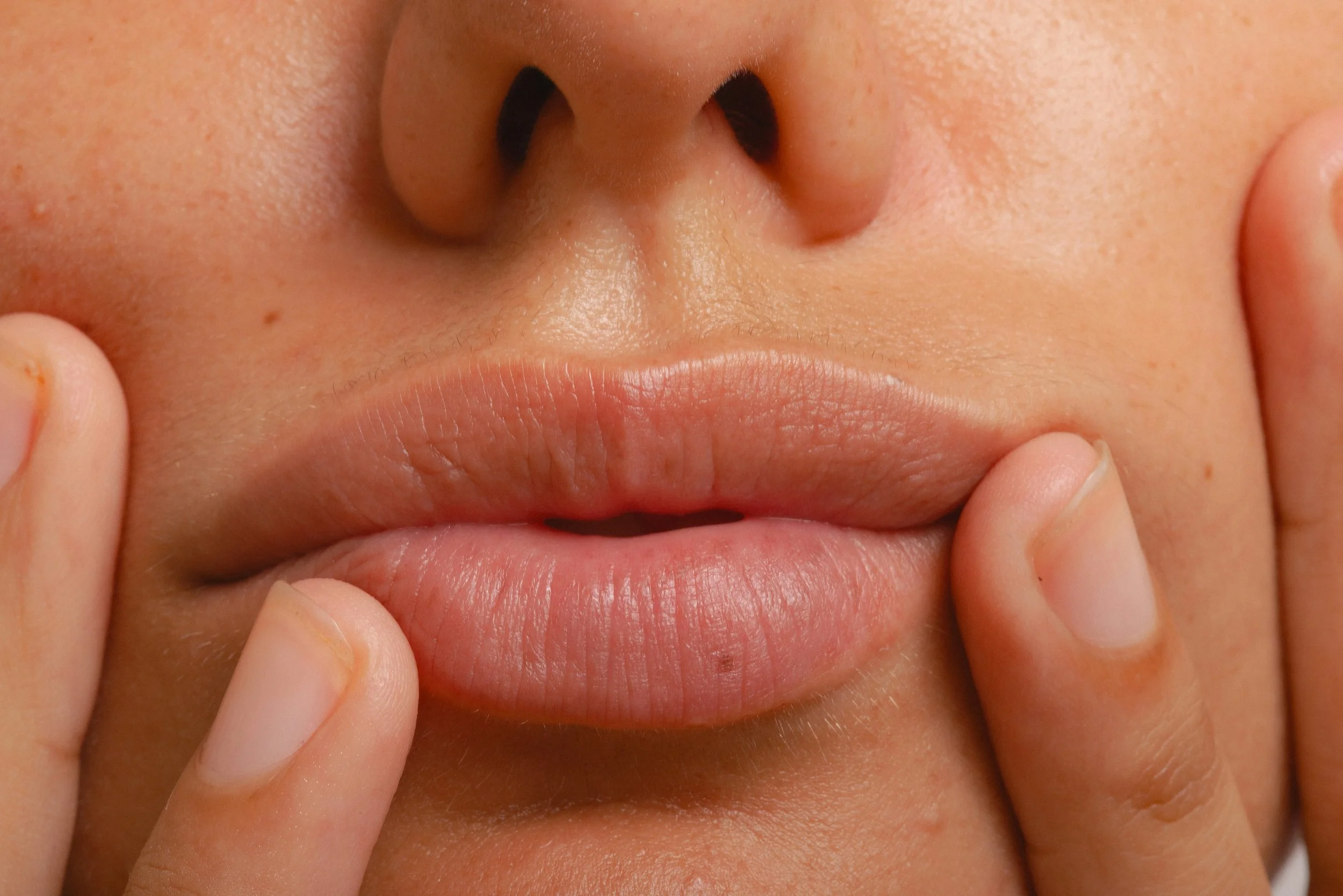 Close-up of naturally full lips showing the type of results targeted by the ProDeep collagen-stimulating laser treatment