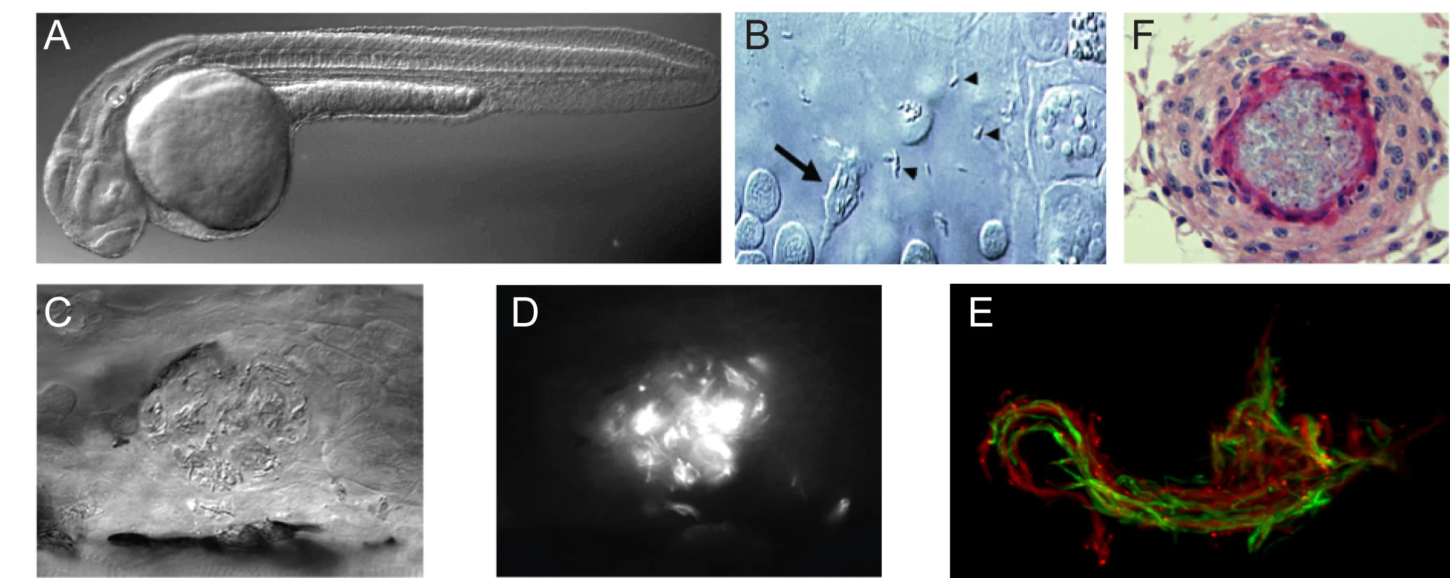 Pathogenic stages of M. marinum infection of zebrafish. (A) Optically transparent zebrafish larva. (B) Differential interference contrast (DIC) microscopy image of infected macrophage (arrow) phagocytosing extracellular mycobacteria (arrowhead). (C) DIC image of early granulomas. (D) Epifluorescent image of C showing fluorescently labelled M. marinum inside individual macrophages. (E) Confocal microscopy image of cording M. marinum (red and green fluorescent strains used to emphasize cording phenotype) in a 5dpi infected larva. (F) Immunohistology of a mature granuloma in an adult infected zebrafish at 8 weeks post infection