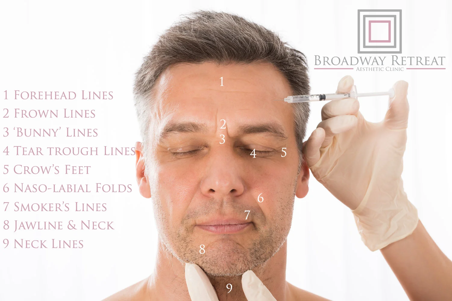 AntiWrinkAreas.jpg