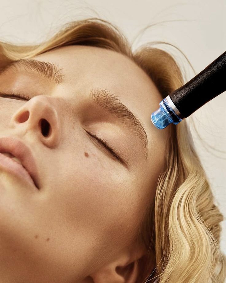 Microdermabrasion oder Hydrafacial – was ist besser? Meine persönliche Erfahrung als Beauty-Expertin in Hamburg