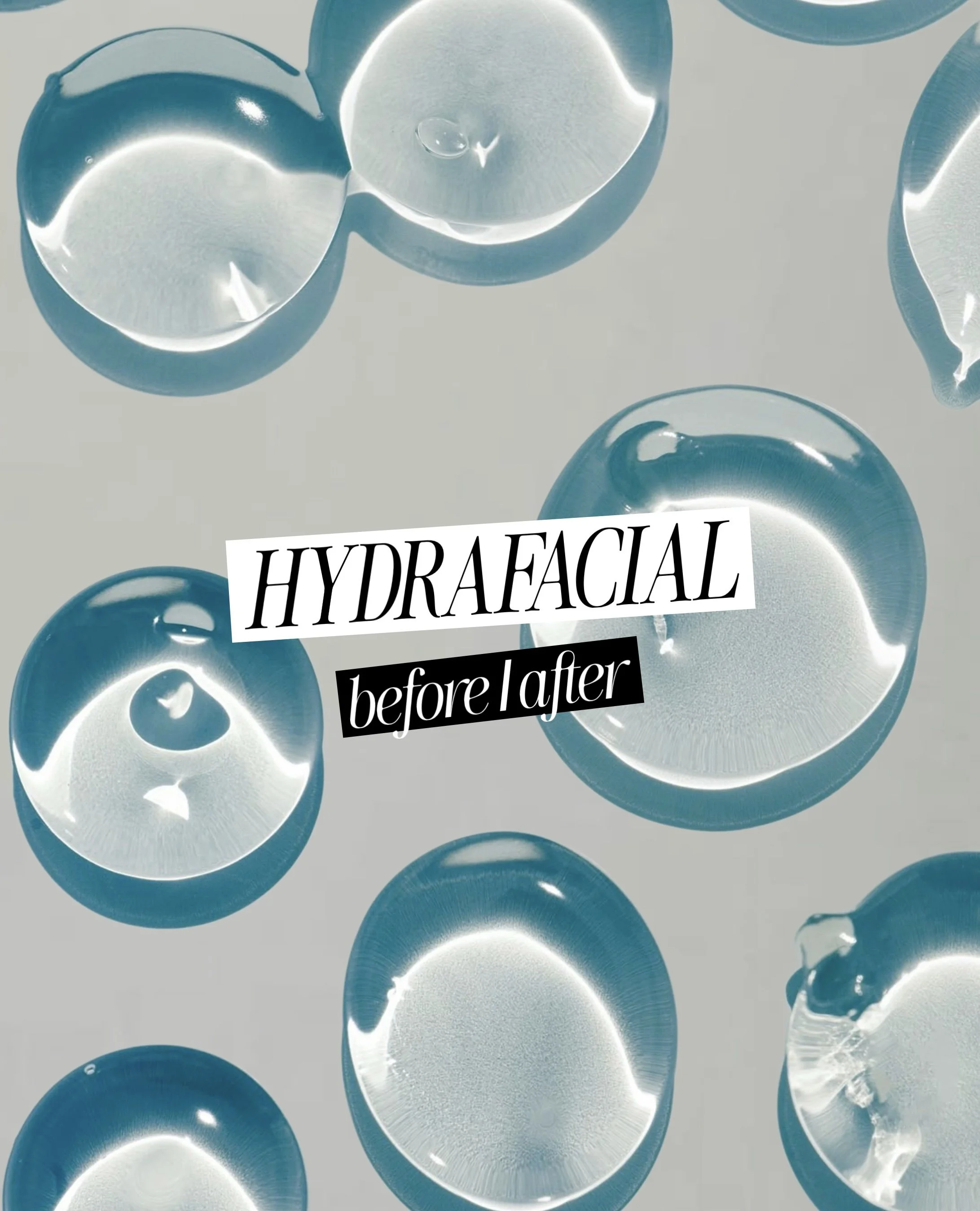 Hydrafacial in Hamburg vorher nachher – sichtbare Ergebnisse schon nach der ersten Behandlung