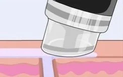 Step 4: Hydration